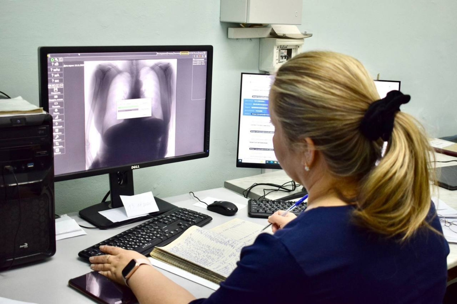 В Башкирии 380 тысяч рентгенов обработано ИИ